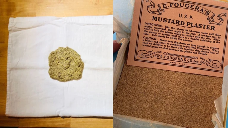The Forgotten Power of Mustard Plasters: How Our Grandparents Fought Illness Without Expensive Medications